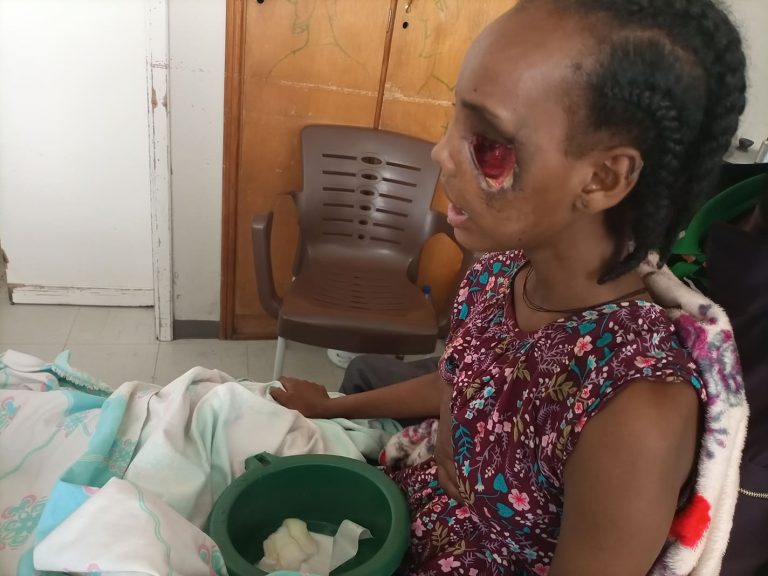 Beriha Gebray’s story: An Eritrean soldier shot her and destroyed her eyes.